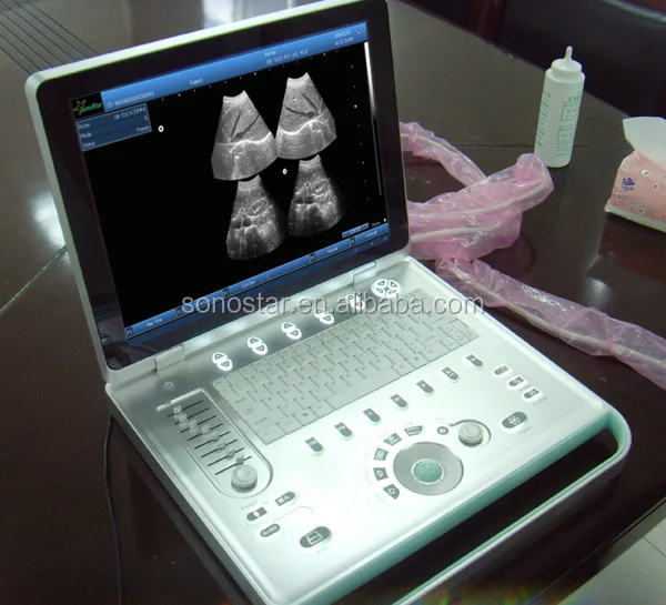 
3D 4D laptop ultrasound machine for pregnancy SS-9 Model 