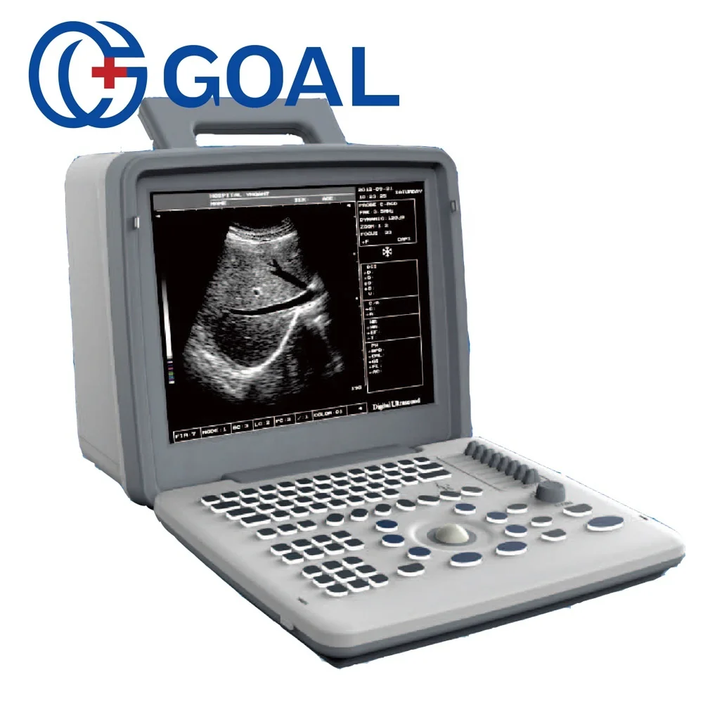 digital ultrasound machine price/ doppler ultrasound