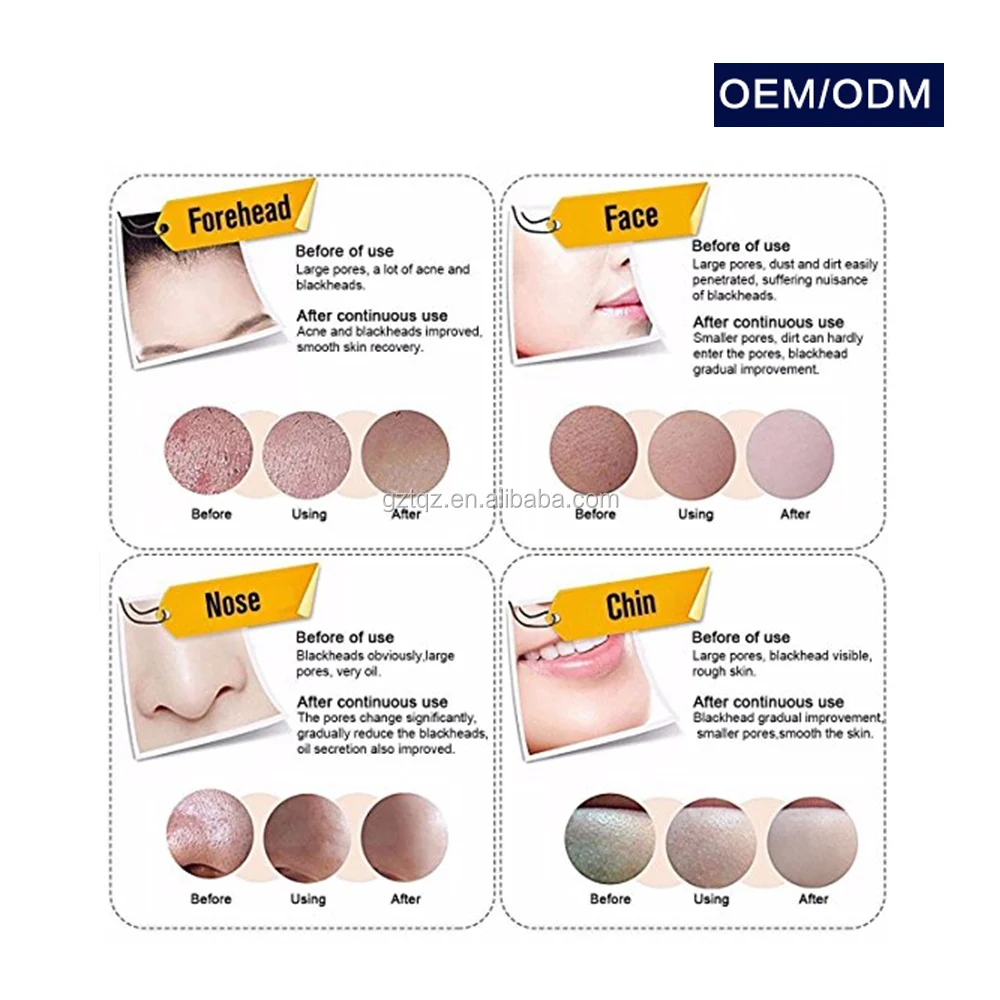 Private Label Charcoal Blackheads  Pores Remove Black Peel Off Gel Face Mask