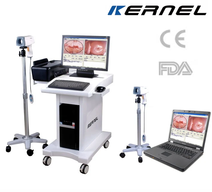 
handheld colposcope KERNEL KN-2200 digital video colposcope for obstetrics gynecology cervical cancer cervix vagina examination 