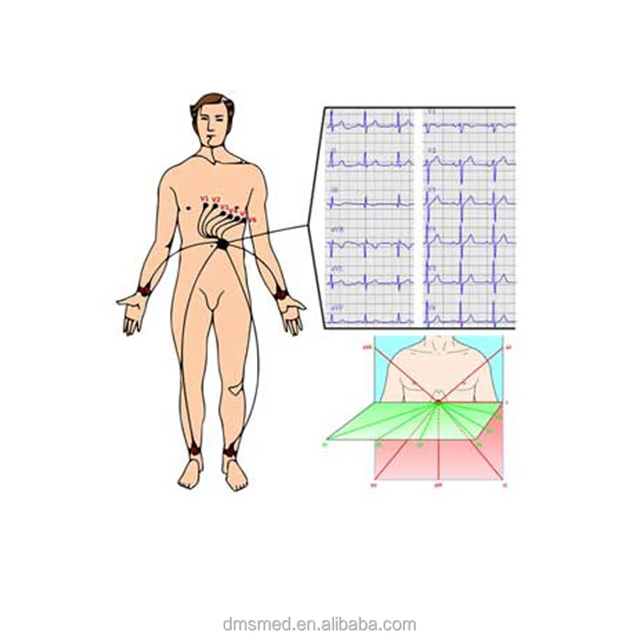 
DMS brand competitive price precio 3 or 12 channel mini ecg holter recorder monitor with ecg cable and software 