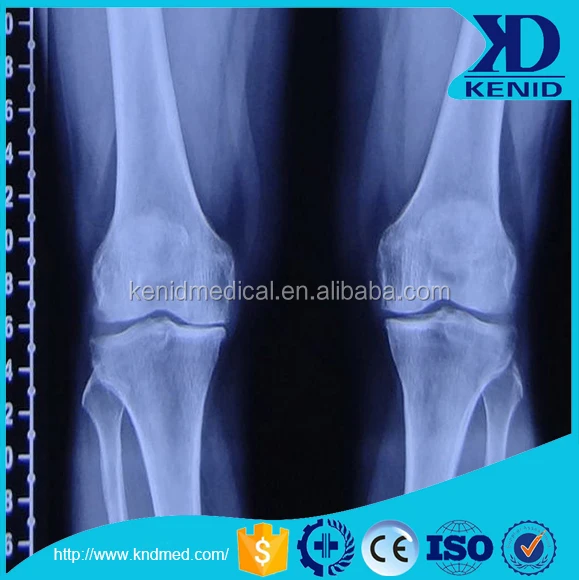  x ray equipment sale compatible fuji & agfa cr KND-A/F xray film 8x10inch