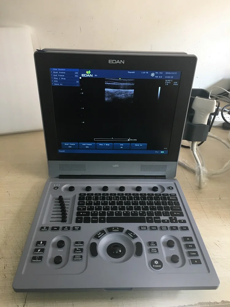 Портативный ультразвуковой допплер edan u60 с режимом CW