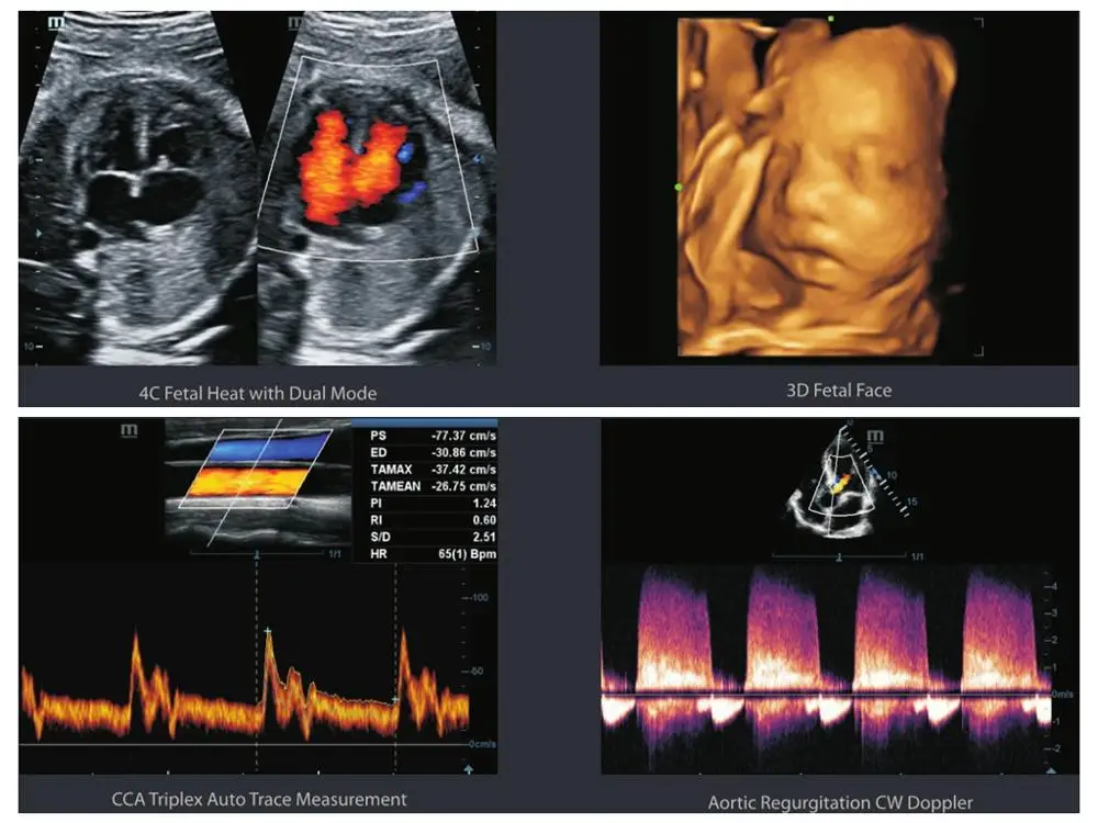 Premium Mindray DC-60 trolley 3D/4D Color Doppler Ultrasound machine for hospital DC60