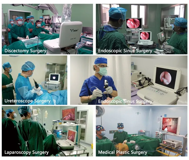 Камера для артроскопии эндоскопия для артроскопической хирургии