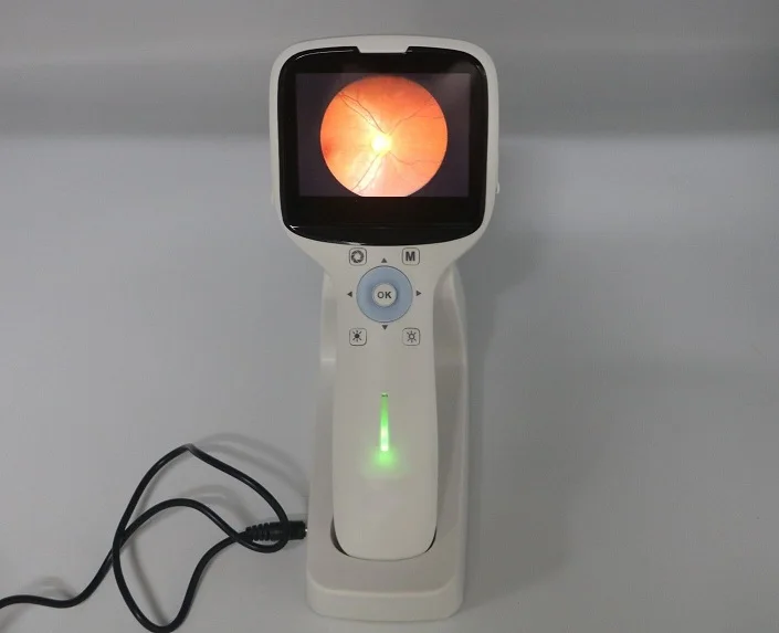 Non-mydriatic Portable Digital Fundus Camera