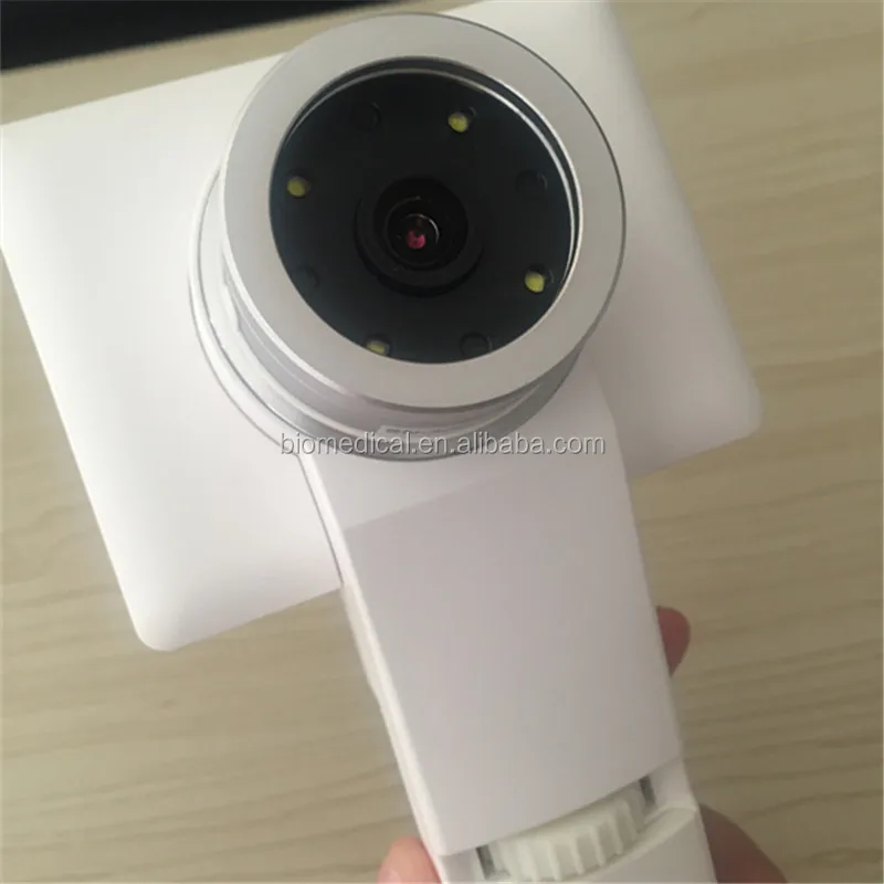 3.5 inch Color Screen Otoscope Endoscope Parts Handheld ENT Inspection Equipment With CE Certificate