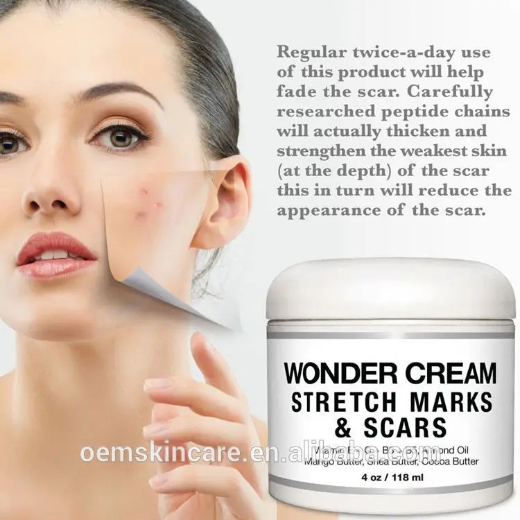 Фирменная торговая марка 100% натуральный крем для Удаления растяжек от акне