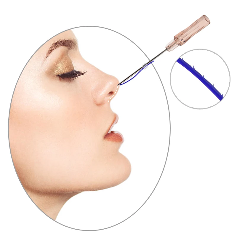 
Beauty new 19G cog nose rhinoplasty pdo thread 