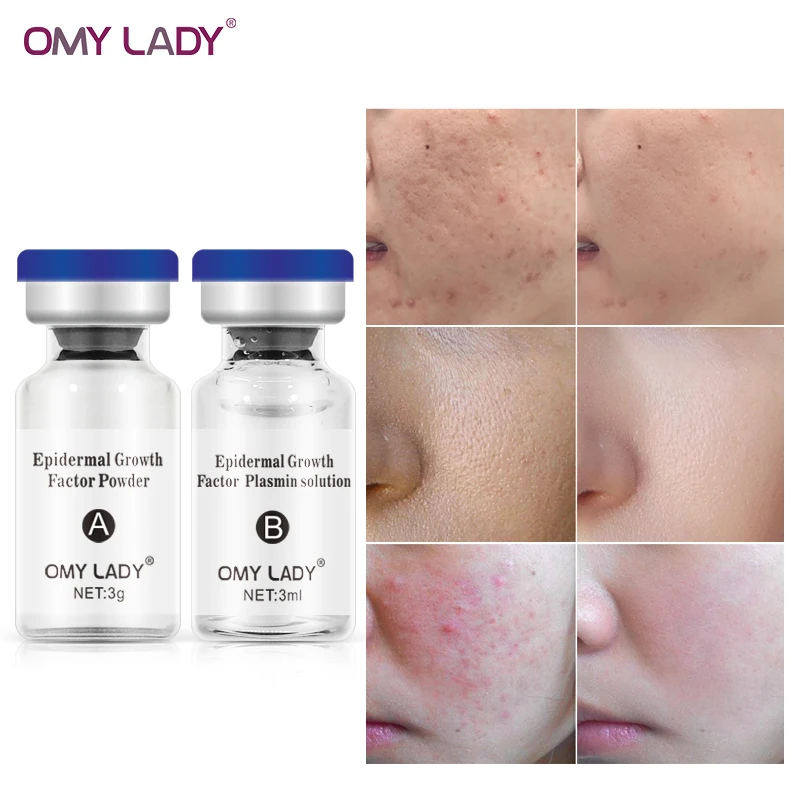OMY LADY EGF Repair Face Serum Kit For Acne Scar Removal best Anti Aging Serum Private label