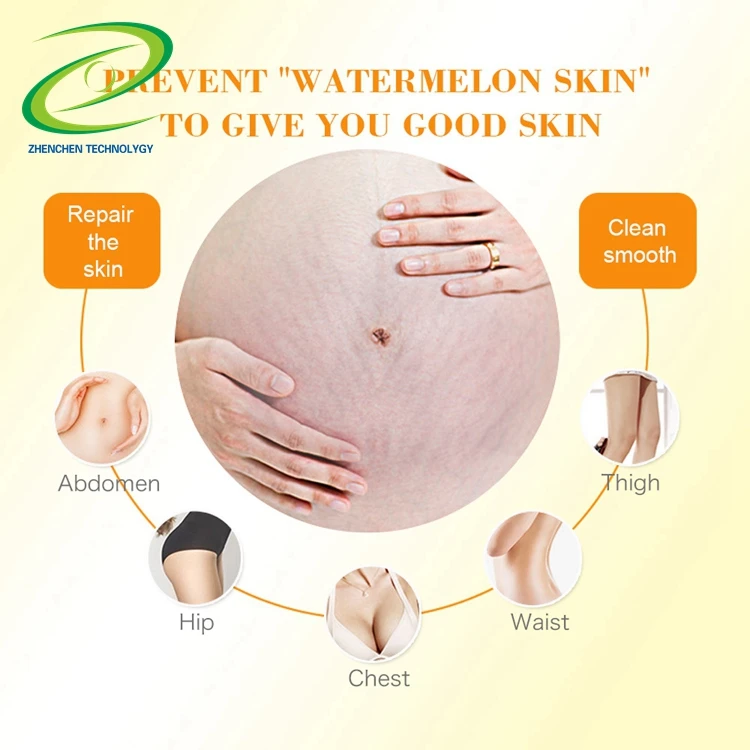 
UONOFO OEM ODM non toxic repair pregnant line precious skin body cream skin smoothing body remove stretch marks removal cream 