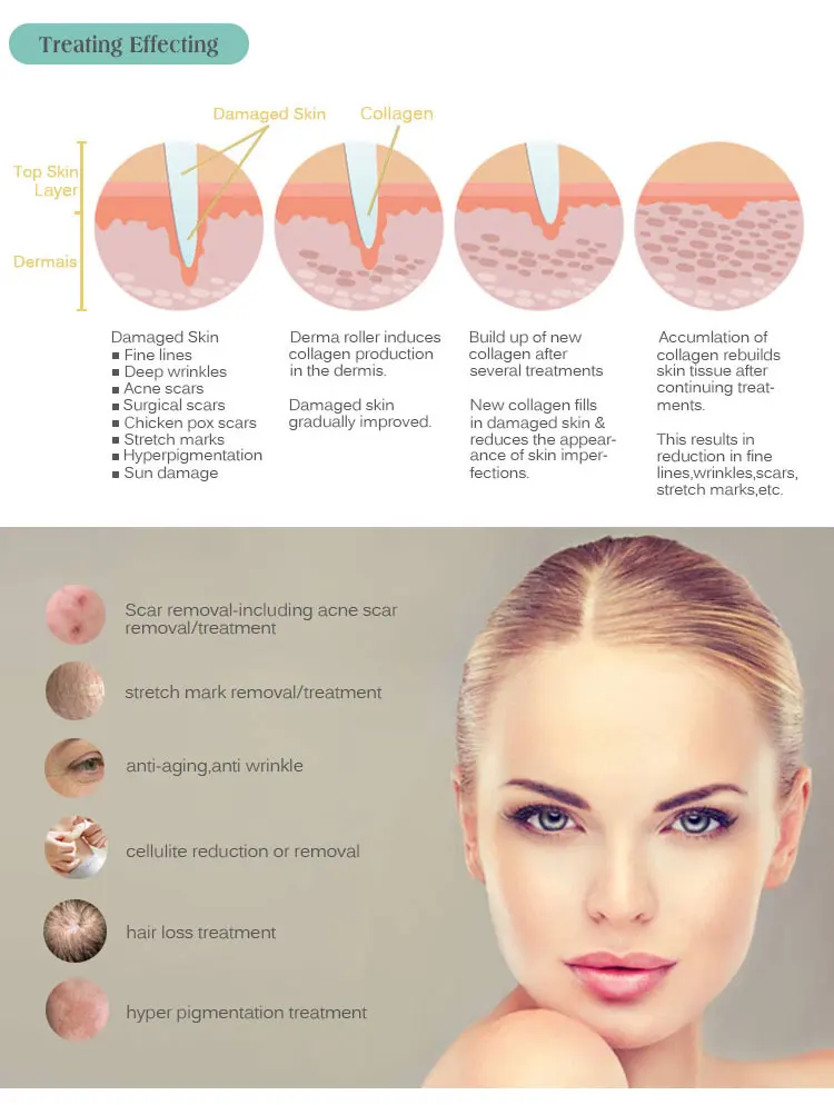 Beautforever DRS derma roller 192 microneedle mesotherapy dermaroller