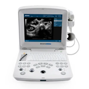 Edan ultrasound machine /ultrasound portable edan dus 60