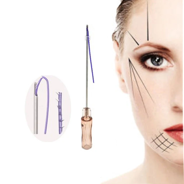 
Absorbable Suture Type face lift pdo threads for face lifting 