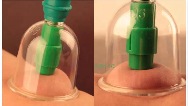 Cupping Vacuum Cupping Set Traditional Chinese 12 Cups Transparent English Treatment Chinese Medical Acupuncture Class I