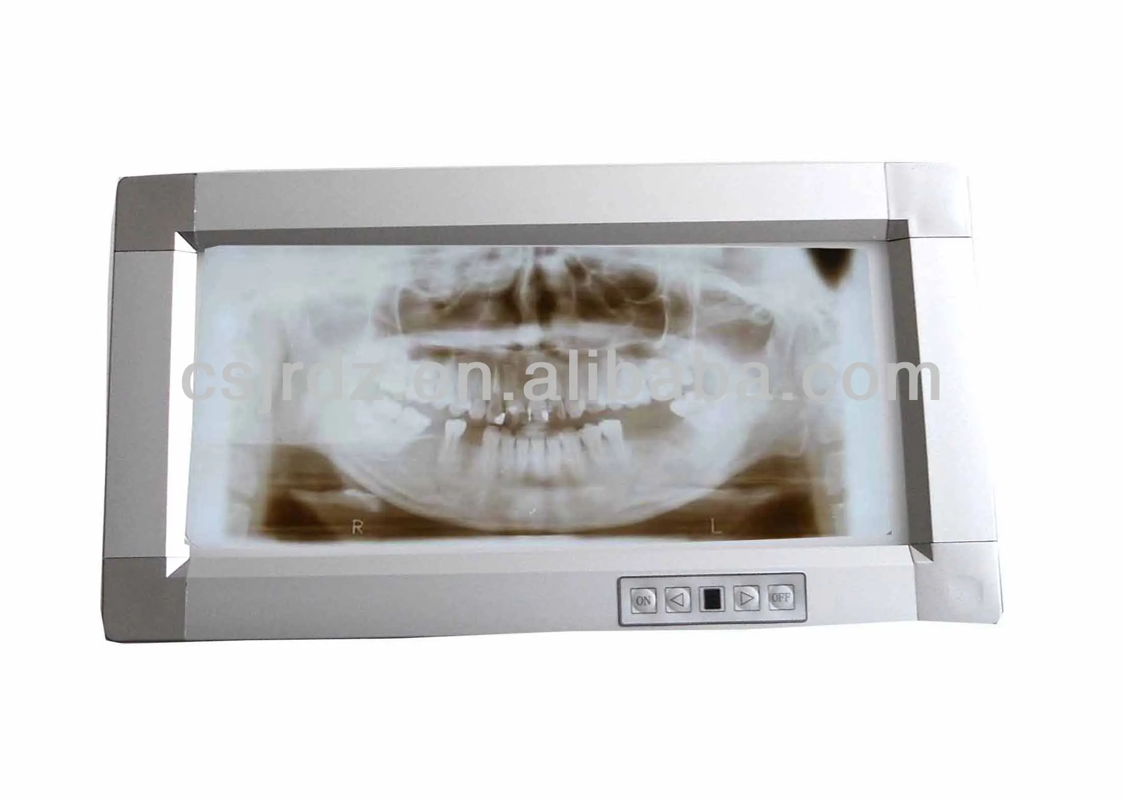 Dental x ray viewer ( dental LED illuminator )