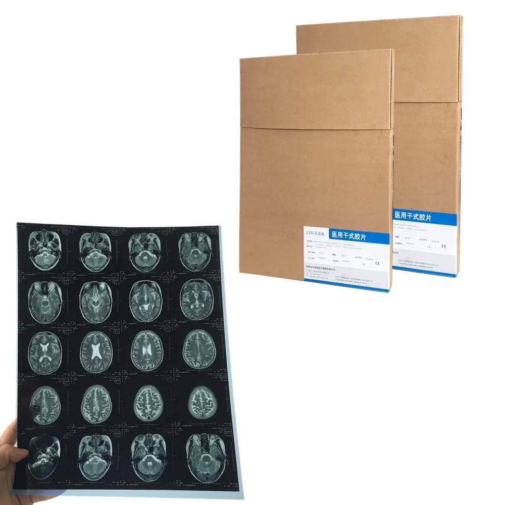 Thermal medical X-ray film for mri/cr/ct scan