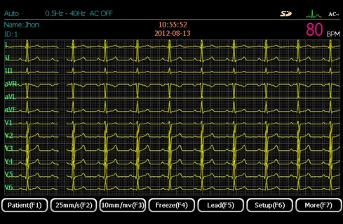 EM-1201B ECGMAC Medical 12 channels ECG machine Foldable ECG