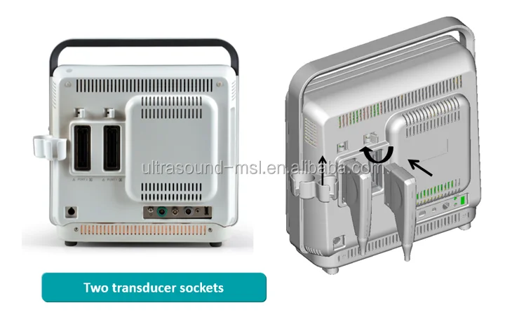 2d portable sonoscape s9 ultrasound machine price/ecografo