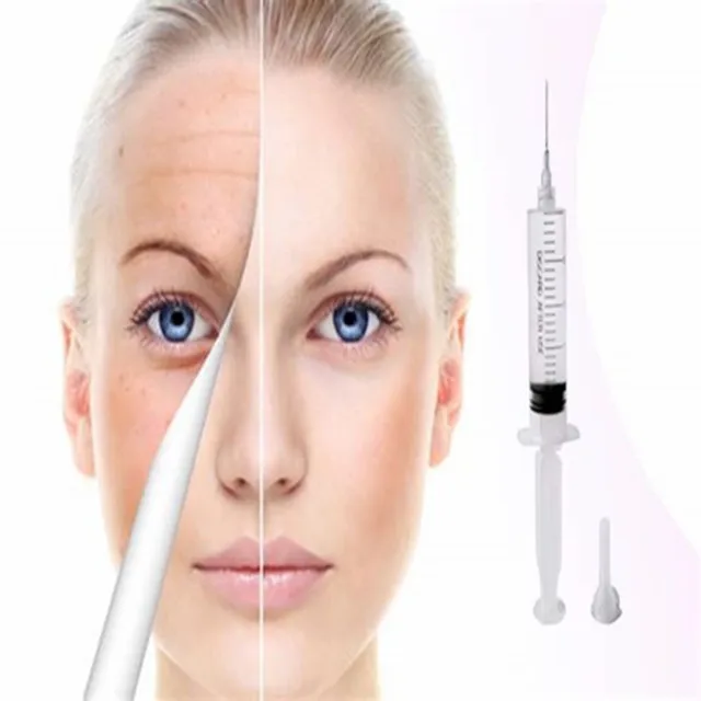 hyaluronic acid filler lips 5ml derm beauty personal care hyaluronic acid filler for lips and cheekbones