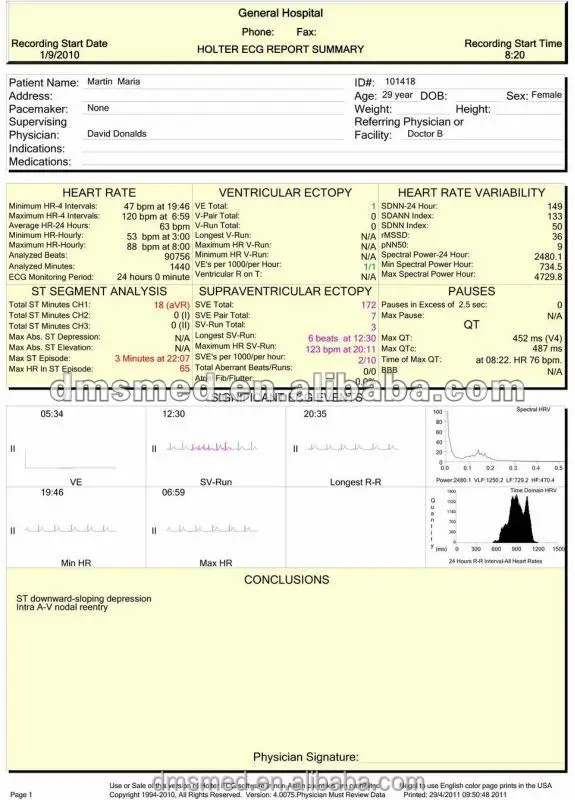 
DMS brand competitive price precio 3 or 12 channel mini ecg holter recorder monitor with ecg cable and software 