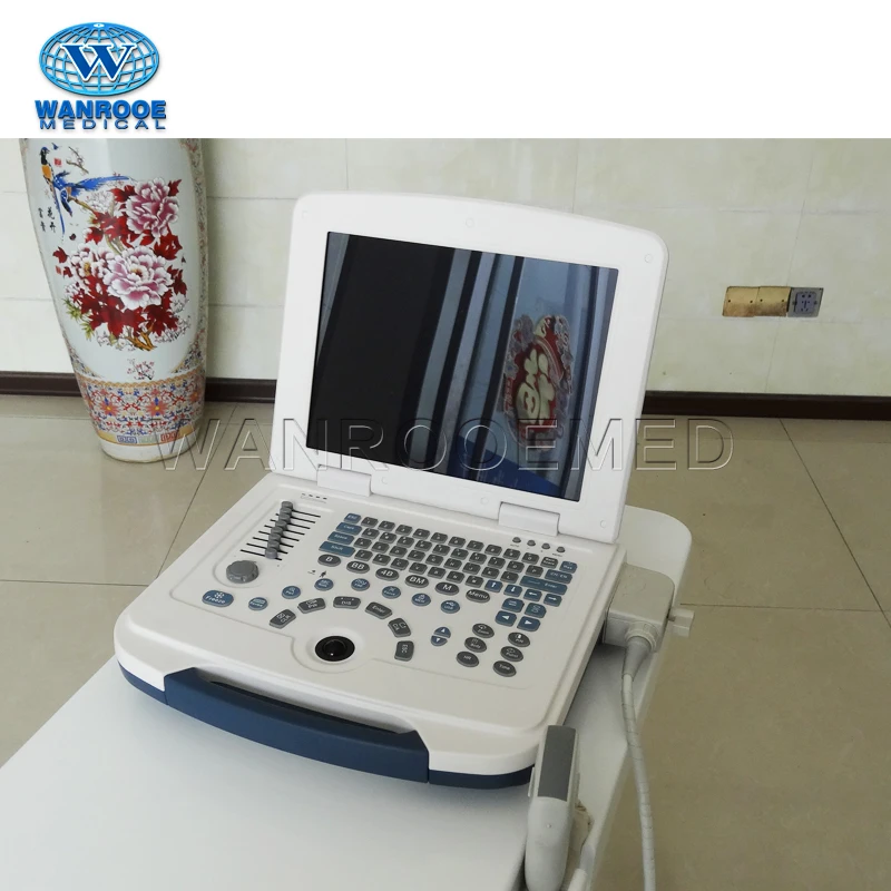 US580 Medical Laptop Portable Echography Therapeutic Ultrasound Machine