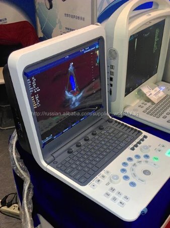 portable color Doppler ultrasound machine