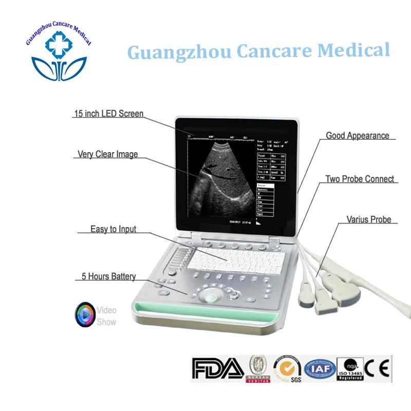
Convex Probe Ultrasound B 