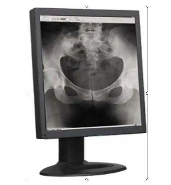 19 inch cctv monitor for xray