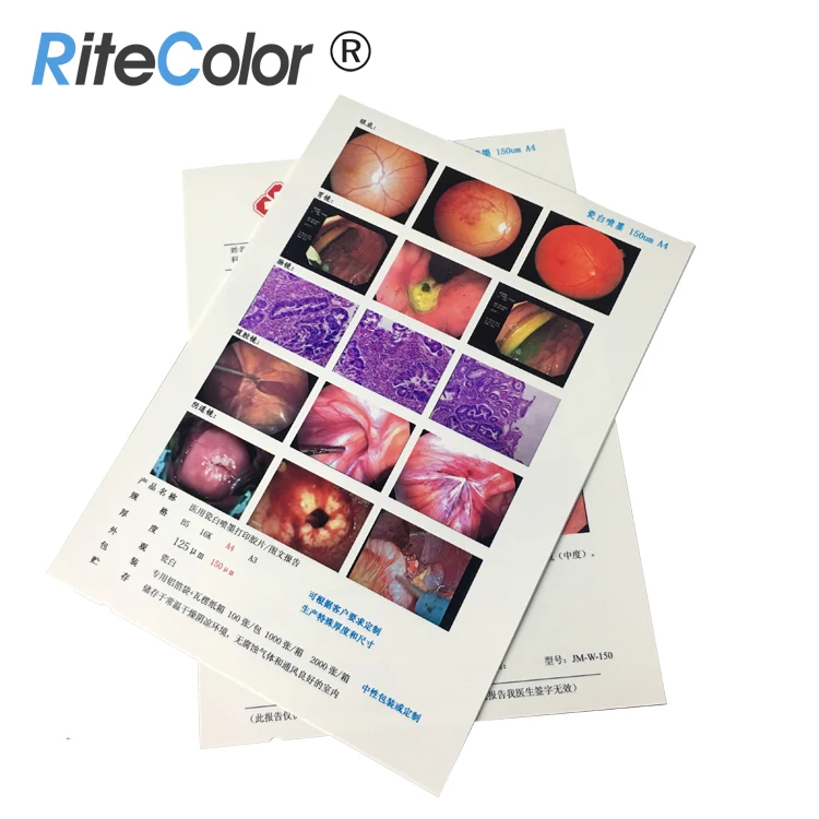 A4 210micron White Inkjet Digital PET Medical Film for Canon Epson Printer