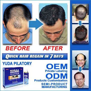 Chinese Trending Hair Care Product YUDA Effective Hair Loss Treatment For Hair Growth