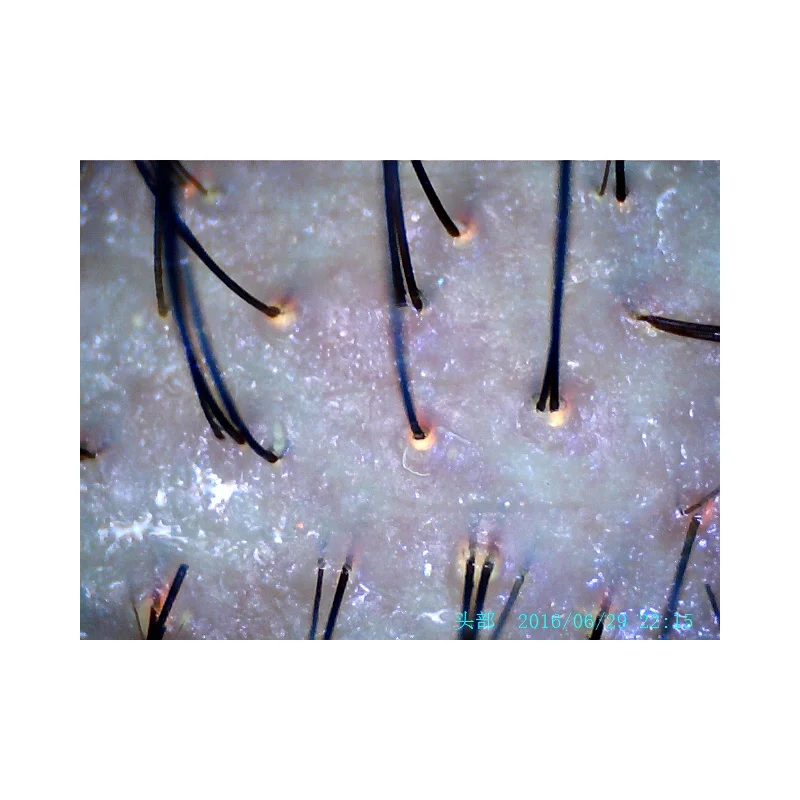 High Quality 8.0 MP HD USB Hair Scalp Scope analyzer