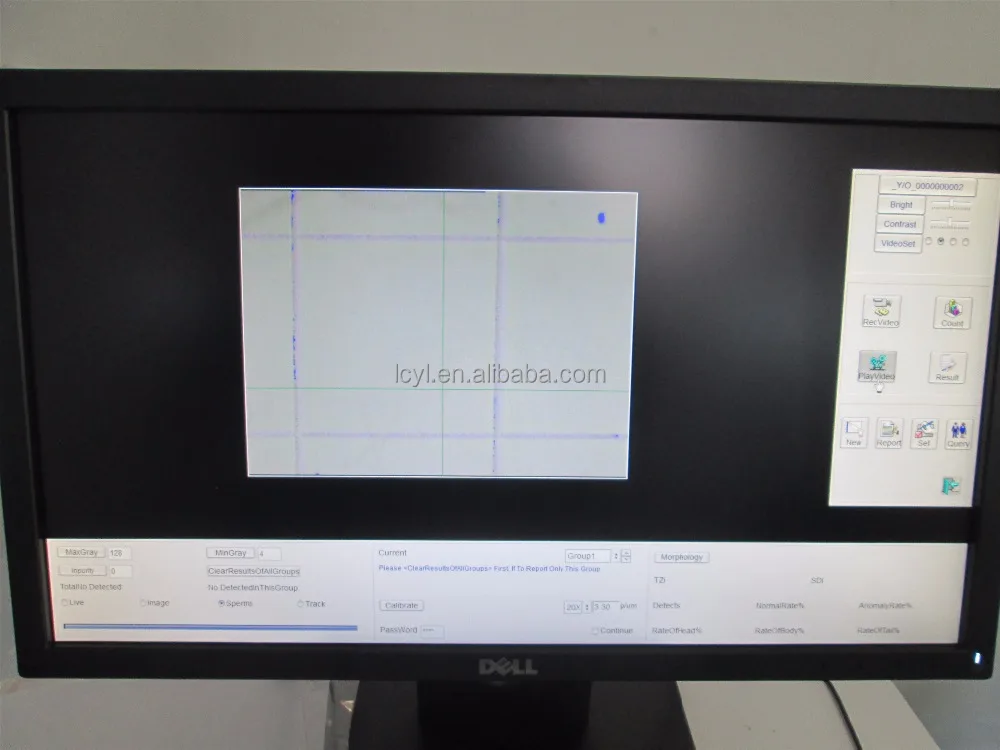 IVF lab computer assisted semen analysis equipment sperm analyzer price