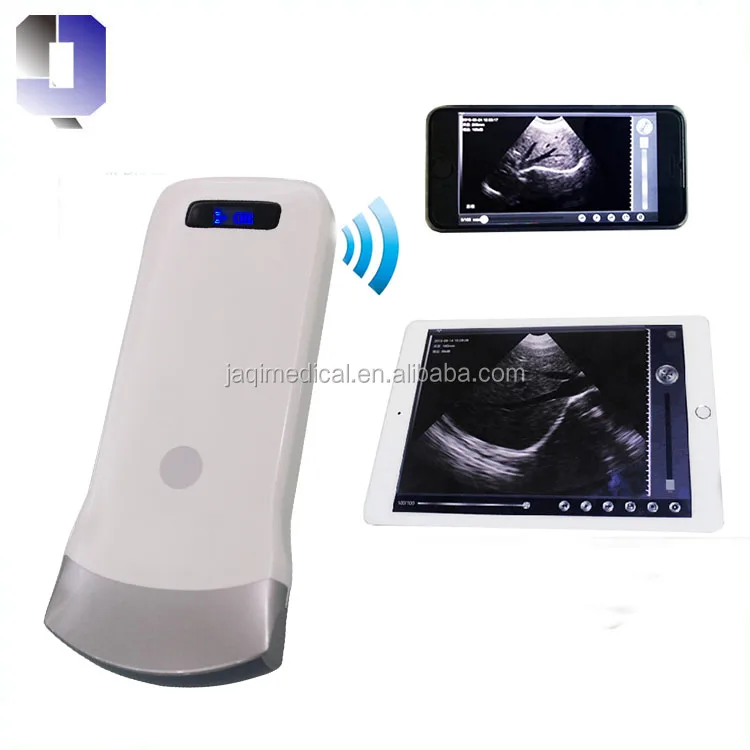 
JQ-C3 Portable wireless B/W convex 80 array elements connect to phone be a ultrasound scanner 