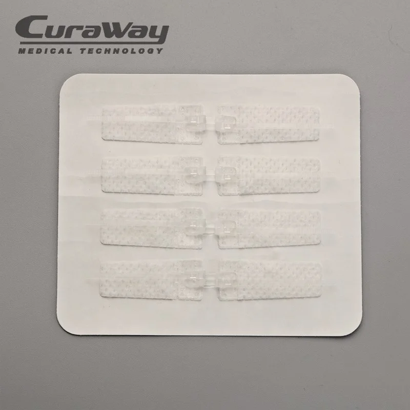 
Noninvasive wound skin closure /Surgcial sutrue device 