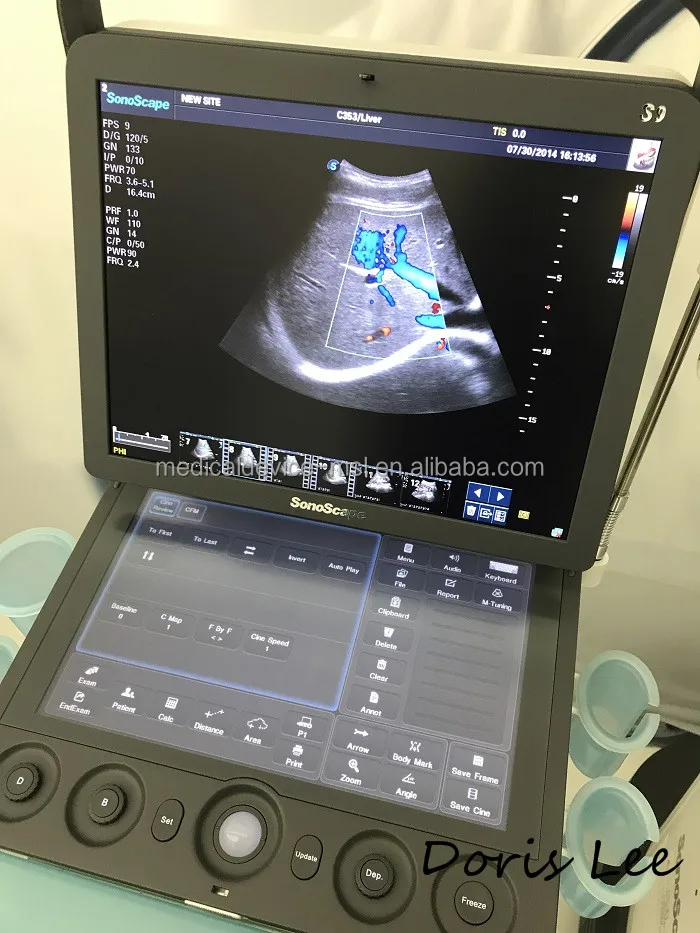 Новейшая модель портативная цветная допплеровская ультразвуковая машина SonoScape S9 цена