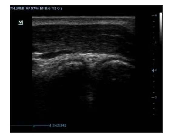 
Mindray dp 30 probe ultrasound/mindray veterinary ultrasound 