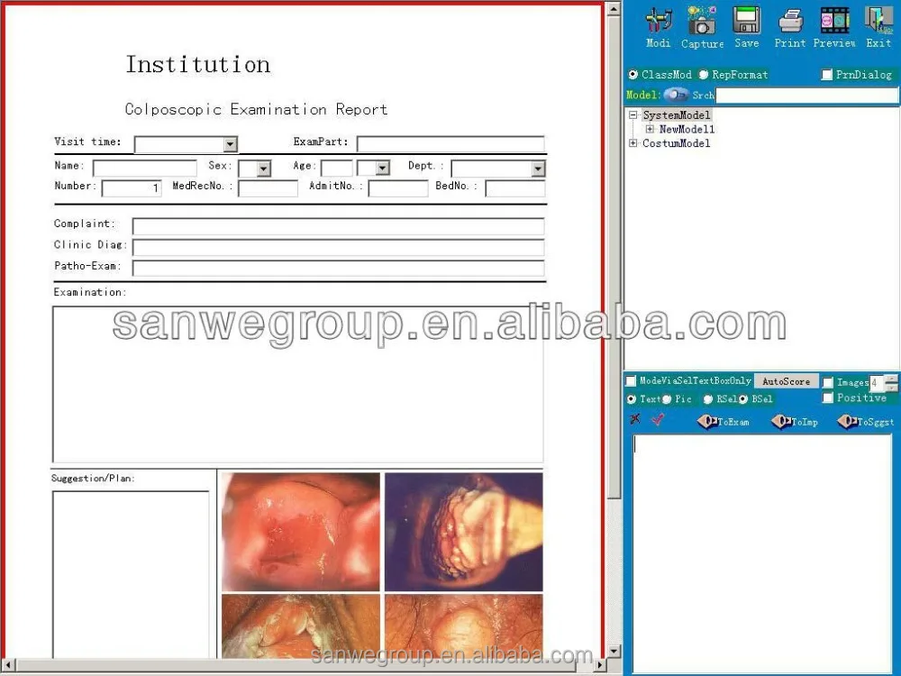 SW-3304 Digital Video Colposcope, Vaginal Colposcope with Camera, Video Colposcope