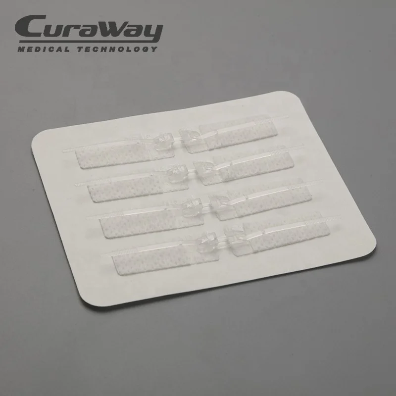 
Disposable Medical Supply Surgical Non-invasive Wound Skin Closure Suture Device 
