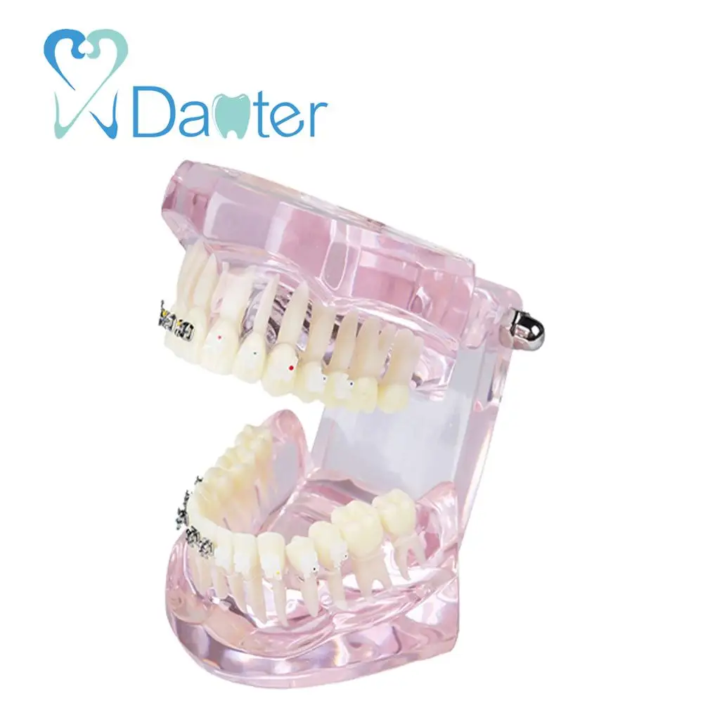 New Arrival Dental Orthodontic Model with Metal and Ceramic Bracket