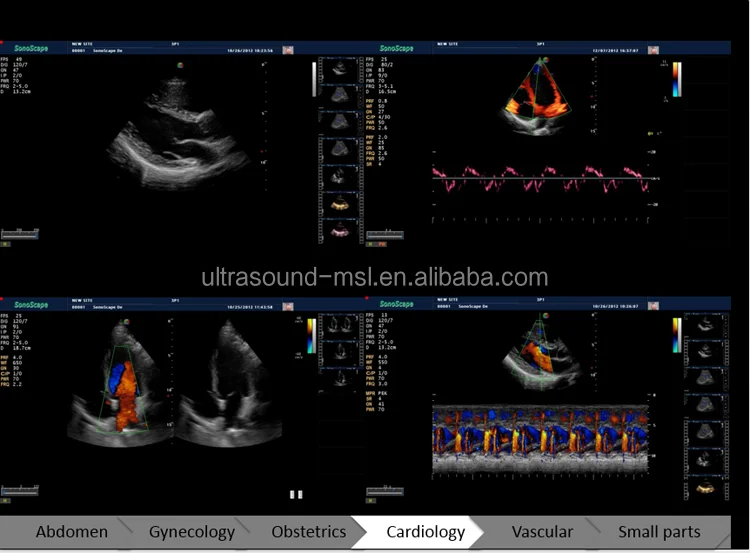 2d portable sonoscape s9 ultrasound machine price/ecografo
