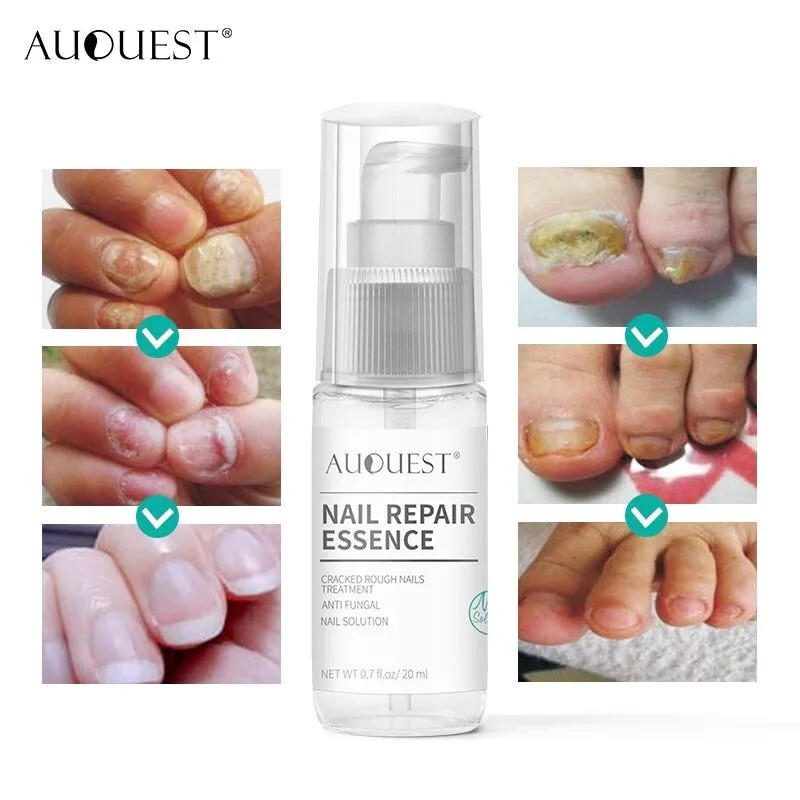 Nail Repair Serum Anti Fungal Foot Care Treatment Onychomycosis Solution Priavte Label
