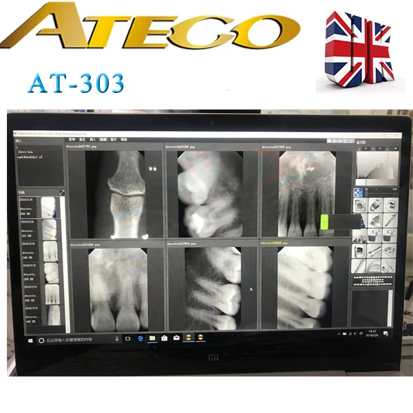 ATECO  digital  x  ray  sensor  dental  rvg  made  in  UK