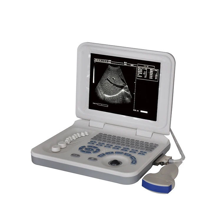 
Gynecological pregnancy examination device portable ultrasound scanner  (60832821887)