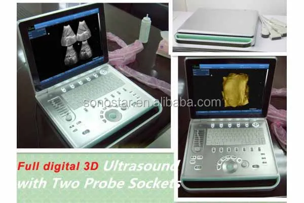 
3D 4D laptop ultrasound machine for pregnancy SS-9 Model 
