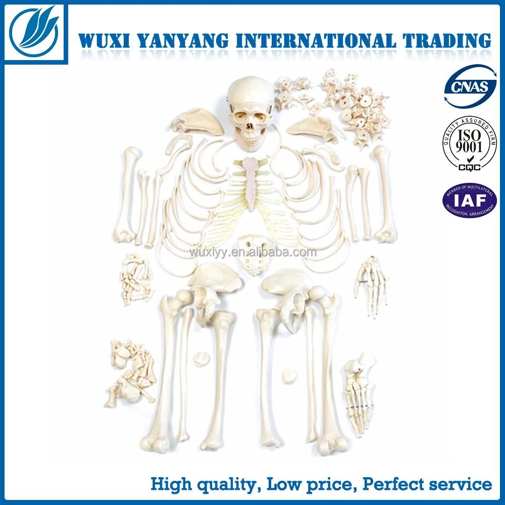 Full Size 170 Cm Human Skeleton with Open Skull, Muscle Painted and Ligament