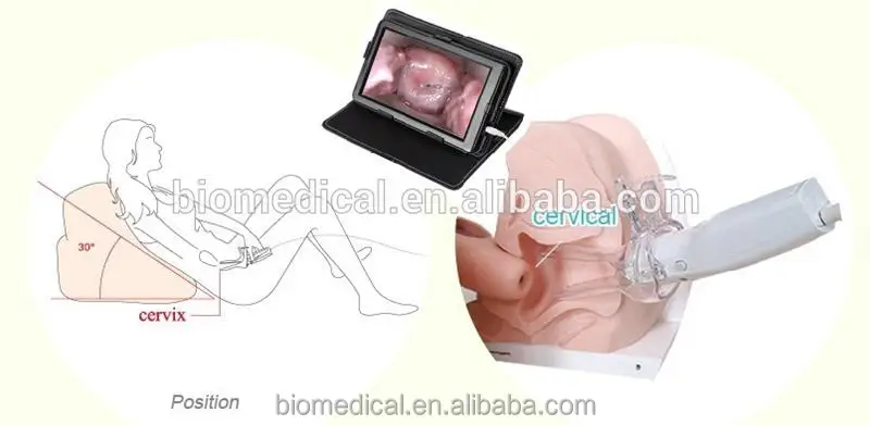 Mini Colposcopy USB Colposcopes For Sale Video Bolposcope Price