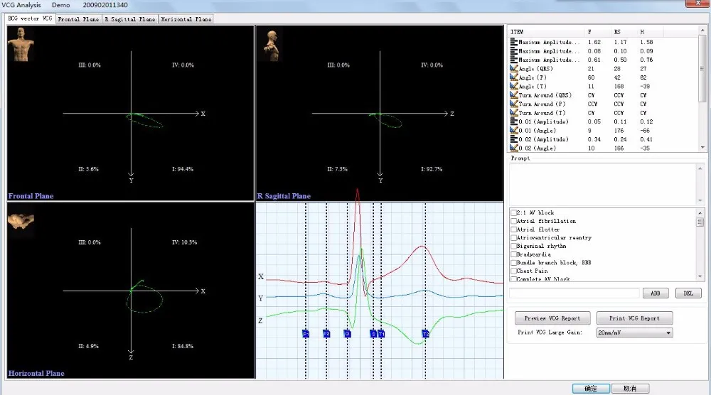 Promotion Product New Digital 3 Channel Holter ECG machine ECG Holter with CE certificate