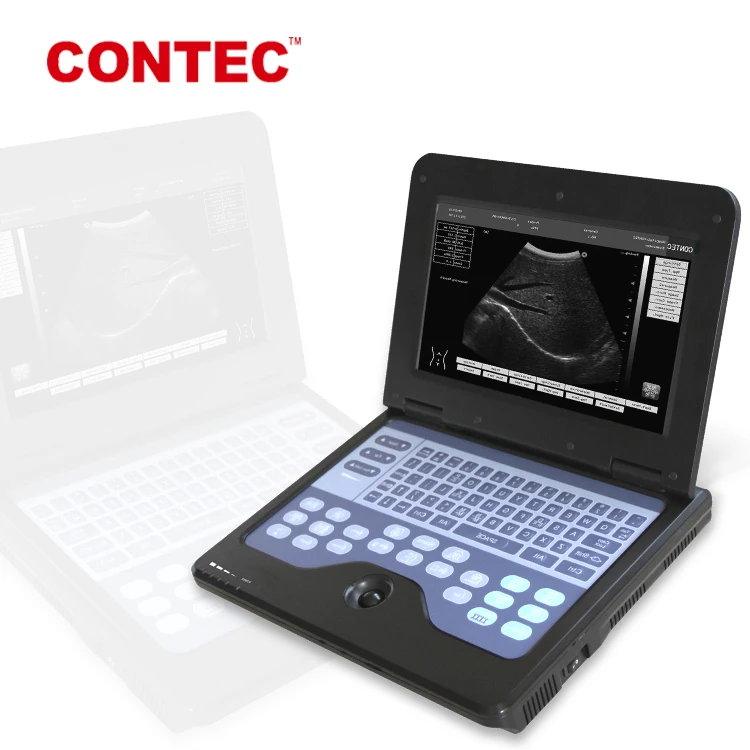 CONTEC CMS600P2 b ultrasound machine by qinhuangdao contec medical