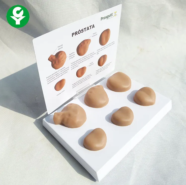 Hot selling Teaching contrast Pathological prostate anatomical model